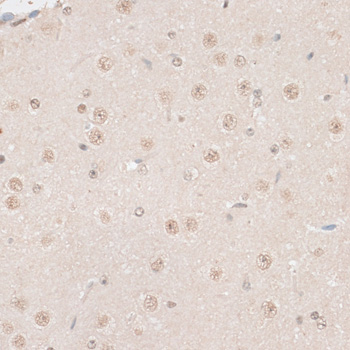 HMGN1 Polyclonal Antibody