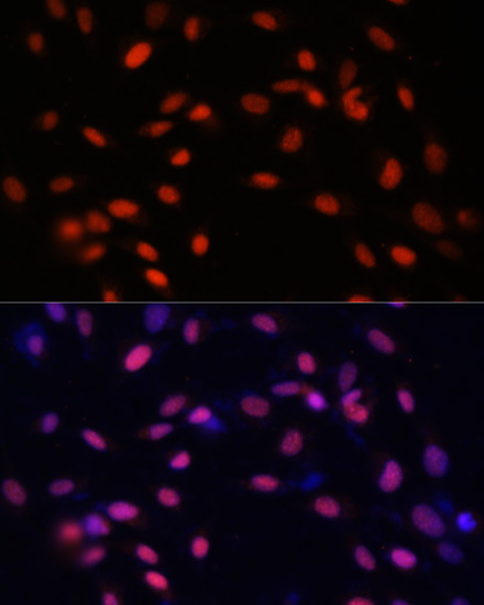 ZNF177 Polyclonal Antibody