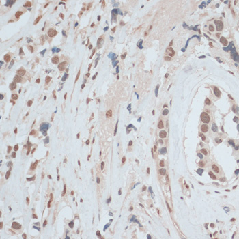 ZNF574 Polyclonal Antibody