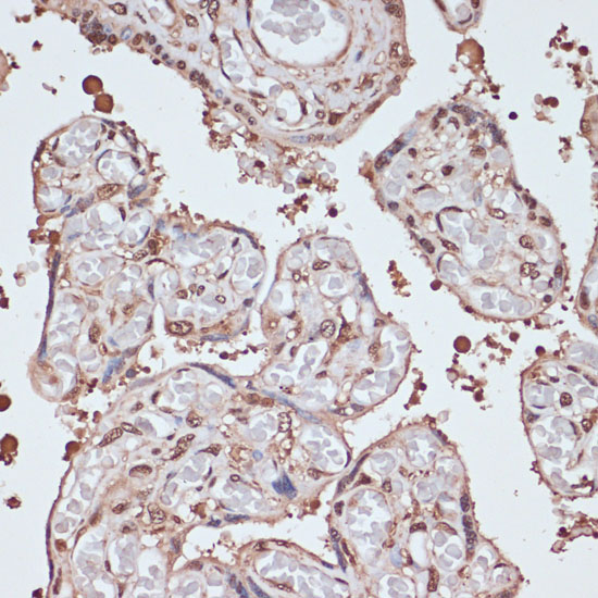 ITCH Polyclonal Antibody