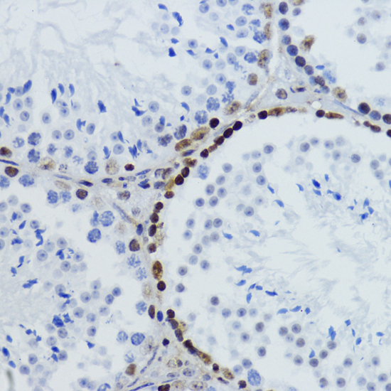 Acetyl-Histone H2B-K12 pAb