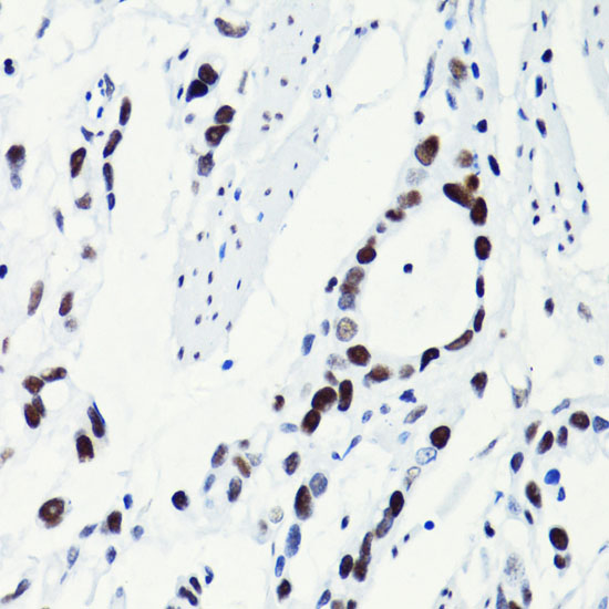 Acetyl-Histone H2B-K5 pAb