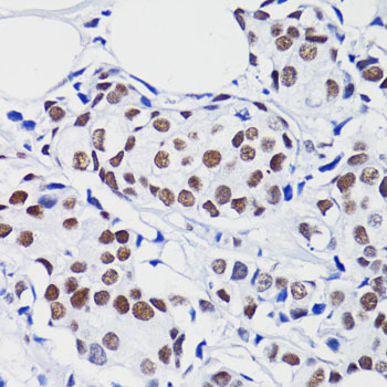 Acetyl-Histone H2B-K15 pAb