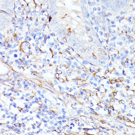 CCDC6 Polyclonal Antibody
