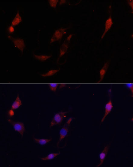 S100A4 antibody