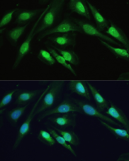 SMAD2/SMAD3 Polyclonal Antibody