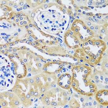 BLOC1S3 Polyclonal Antibody