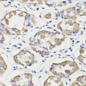 DEPDC6 Polyclonal Antibody