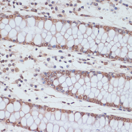 Lamin A / C Polyclonal Antibody