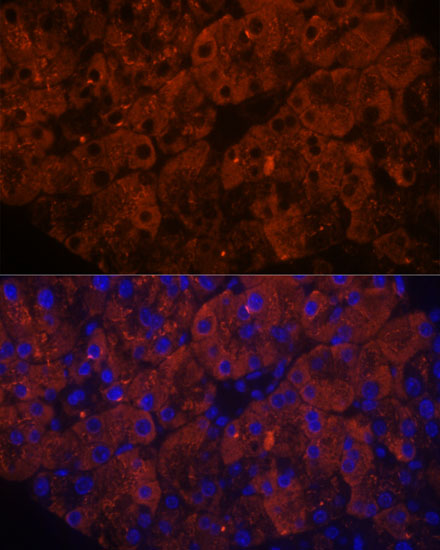 PNLIPRP1 Polyclonal Antibody