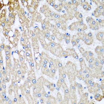COX5B Rabbit Polyclonal Antibody