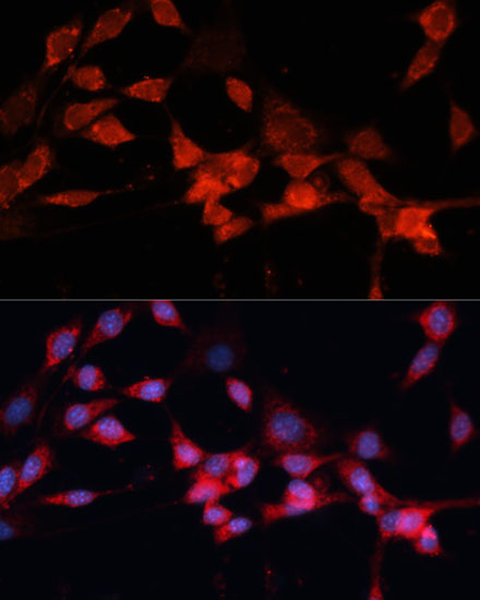 DDB1 antibody