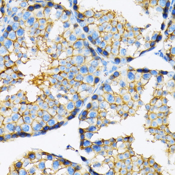 SLC16A1 antibody