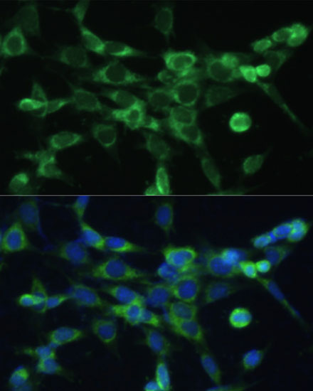 COX6A1 Polyclonal Antibody