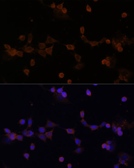 UBE2L3 Polyclonal Antibody
