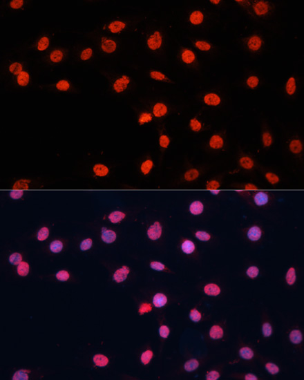 FUS Polyclonal Antibody