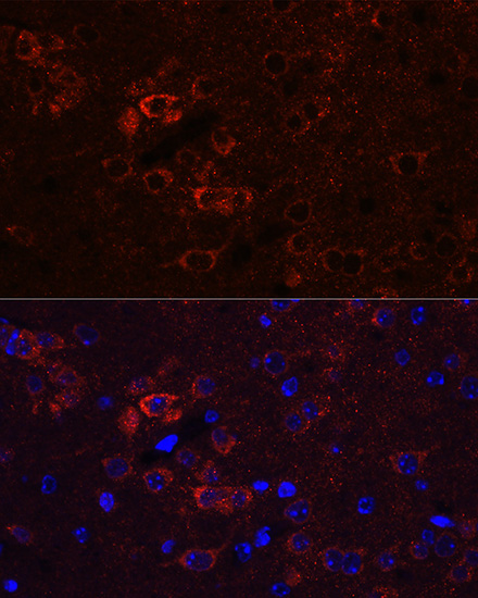 ELAVL3 Rabbit Polyclonal Antibody