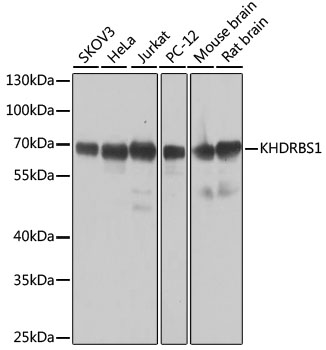 KHDRBS1 Rabbit Polyclonal Antibody