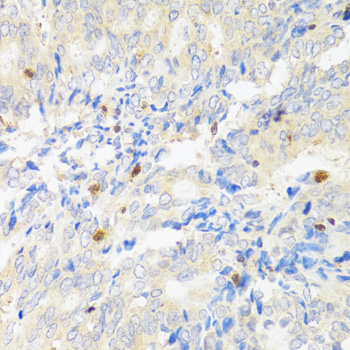 STAT4 Rabbit Polyclonal Antibody