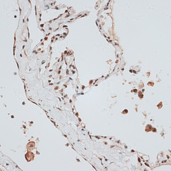 ZNF148 Rabbit Polyclonal Antibody