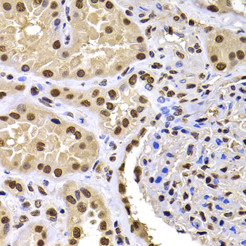 HIRIP3 Polyclonal Antibody