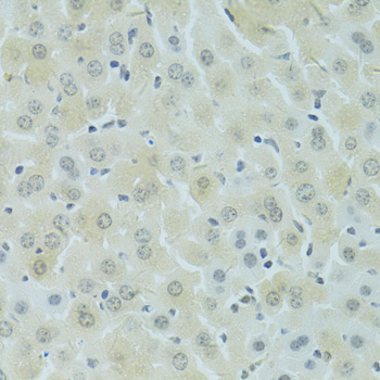 RSRC1 Polyclonal Antibody
