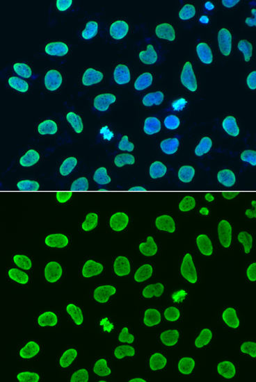 Acetyl-Histone H4-K8 pAb