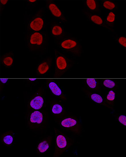 KU70 Rabbit Polyclonal Antibody