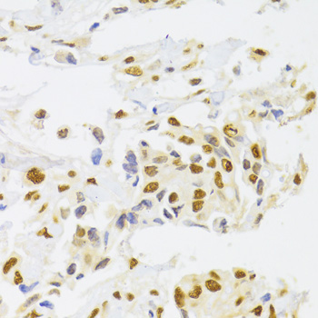 HNRNPA1 Polyclonal Antibody