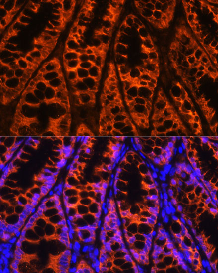 YBX1 Polyclonal Antibody
