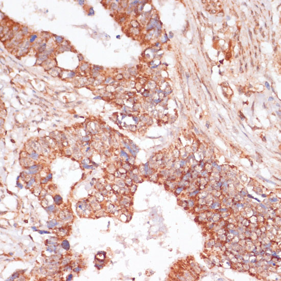 MAP2K3 Polyclonal Antibody