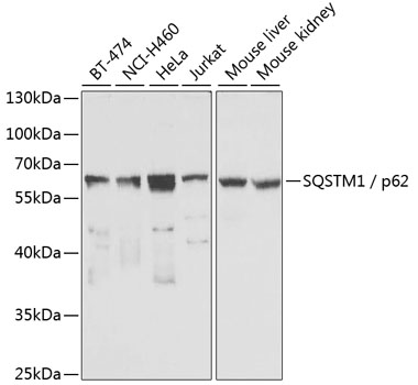 SQSTM1 / p62 Polyclonal Antibody