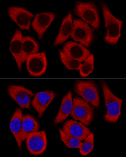 RPL36 Rabbit Polyclonal Antibody