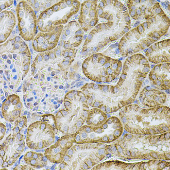 CDH16 Rabbit Polyclonal Antibody