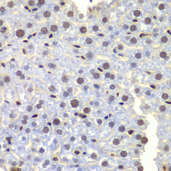 LHX4 Polyclonal Antibody
