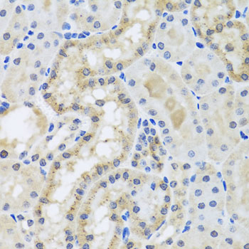 CETN3 Rabbit Polyclonal Antibody
