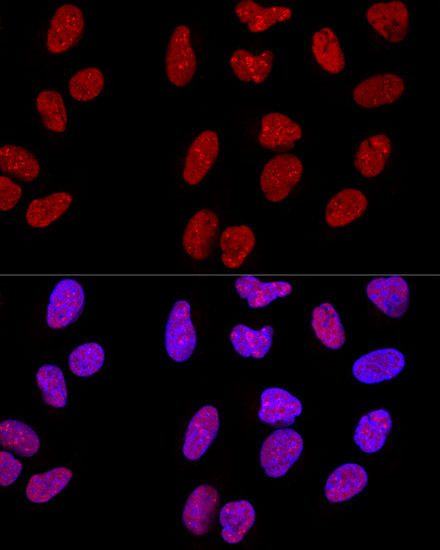 METTL3 Polyclonal Antibody