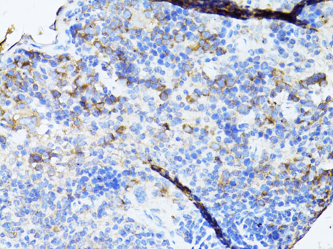 TEFM Polyclonal Antibody