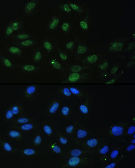 DDX50 Rabbit Polyclonal Antibody