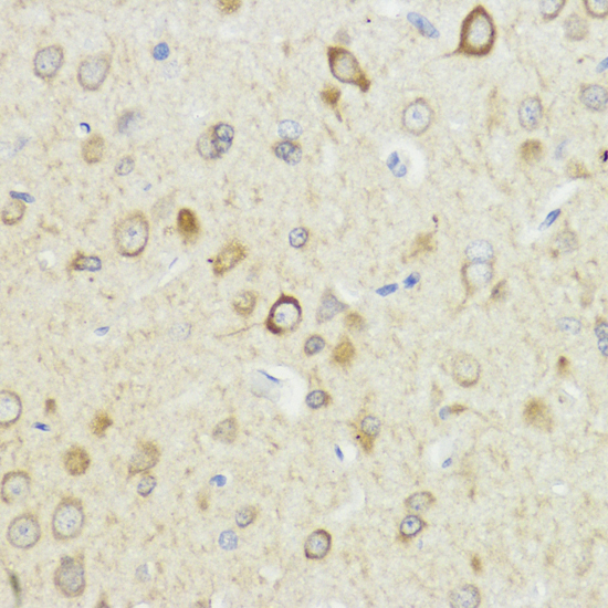 HACE1 Rabbit Polyclonal Antibody