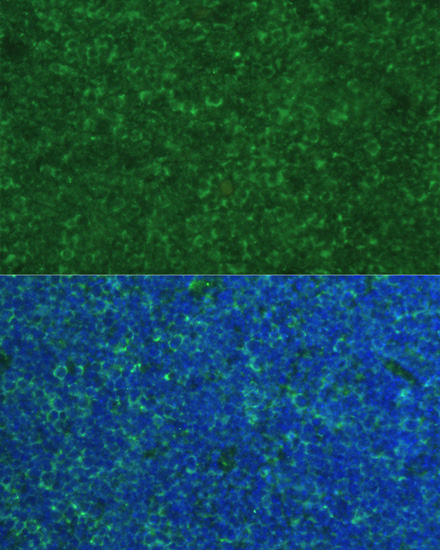 PMAIP1 Rabbit Polyclonal Antibody
