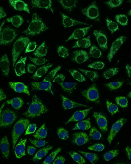 IDH3A Polyclonal Antibody