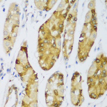 ERLIN1 Polyclonal Antibody