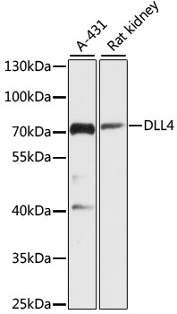 DLL4 Rabbit Polyclonal Antibody