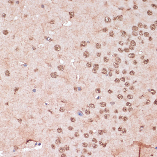 ITCH Polyclonal Antibody