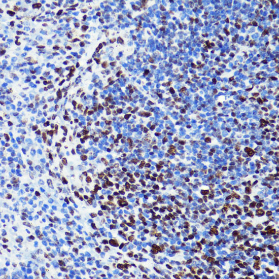 Acetyl-Histone H2B-K5 pAb