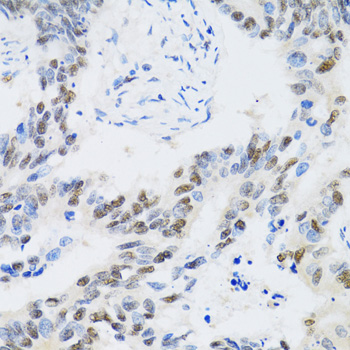 CDK6 antibody