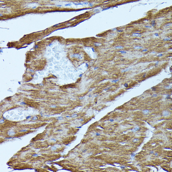 FGD1 Polyclonal Antibody
