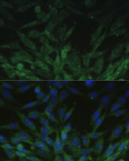 BLOC1S3 Polyclonal Antibody