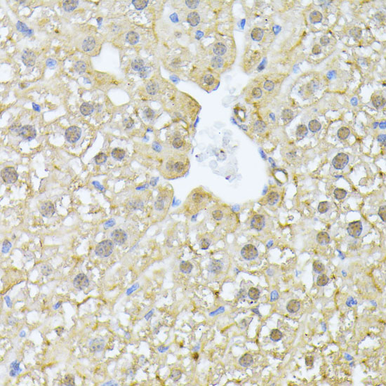 PSMA7 Rabbit Polyclonal Antibody